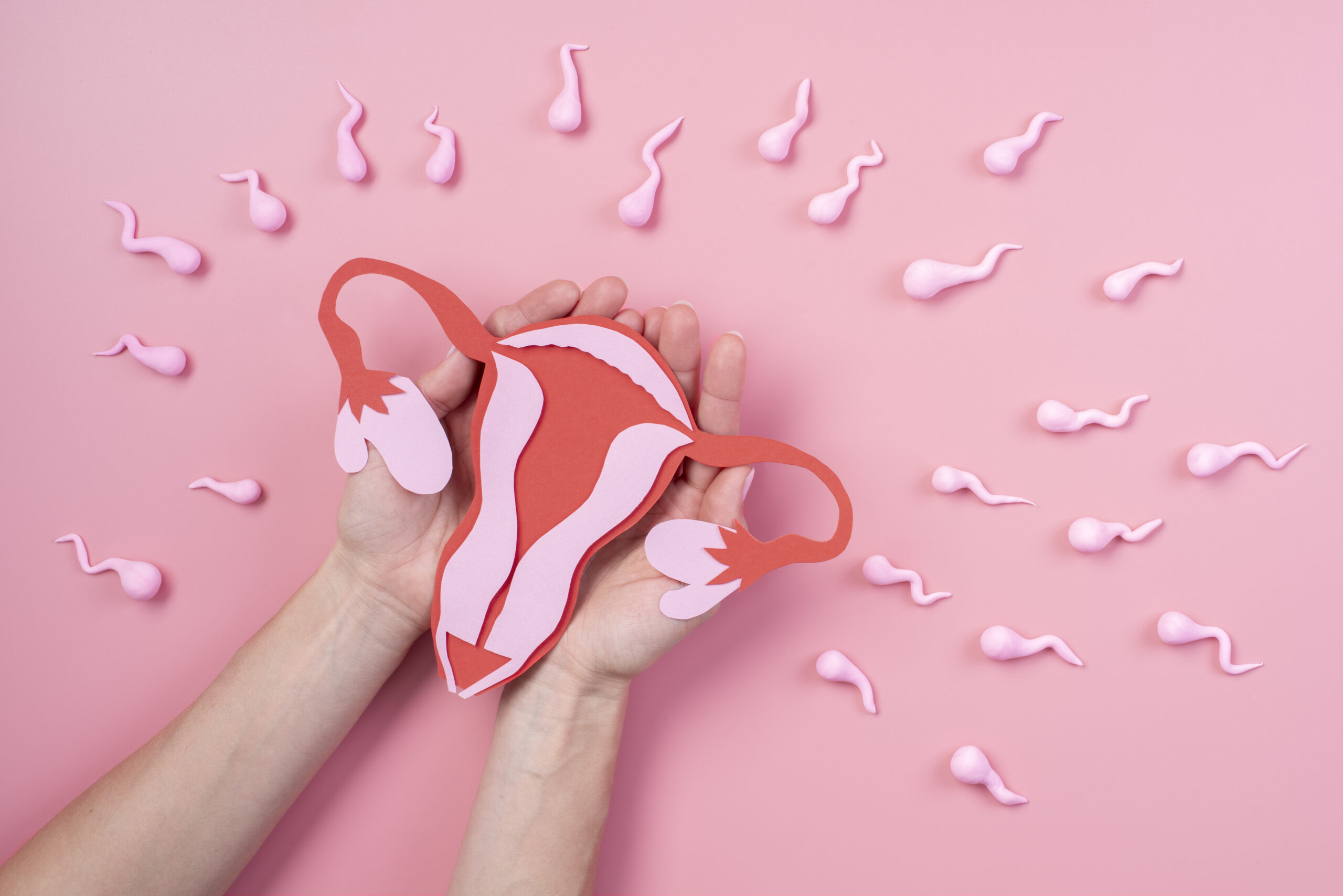PCOD and Its Impact on Infertility